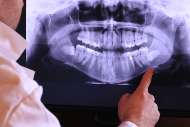 Best Emergency Dental Care for Trauma or Injury in Clearlake Oaks, CA