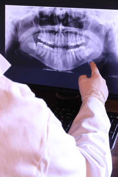 Best Emergency Root Canal Treatment in Clearlake Oaks, CA