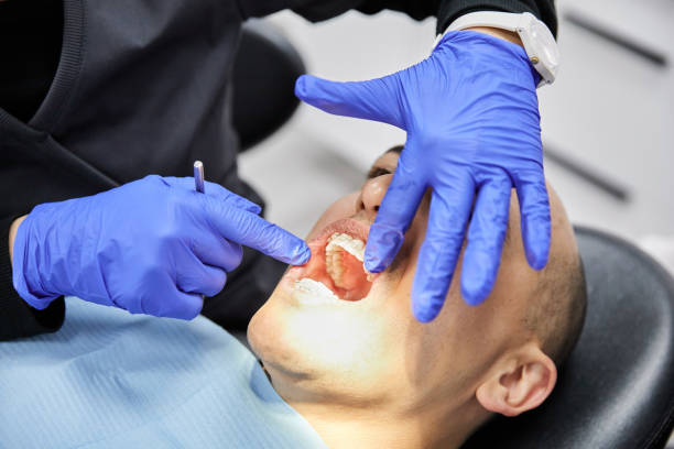 Best Emergency Root Canal Treatment in Clearlake Oaks, CA